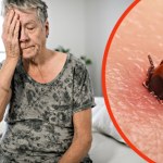 Zespół poboreliozowy - dwie różne definicje i dwa różne podejścia