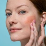 Zgaś rumieńce od zimna niacynamidem 4%. Jak go poprawnie używać?