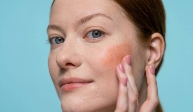 Zgaś rumieńce od zimna niacynamidem 4%. Jak go poprawnie używać?