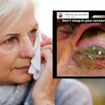 Zgłosiła się z typowymi objawami. Odkrycie przeraziło okulistkę