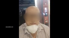 Zgolił włosy i brwi. Wyłudzał pieniądze, udając chorego