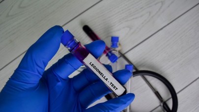 Zgony z powodu legionelli na Podkarpaciu. Obradował sztab kryzysowy