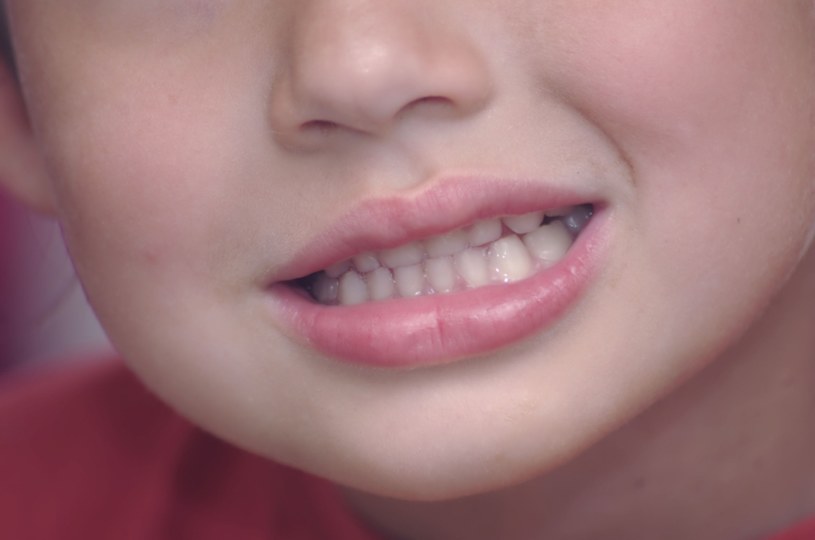 Zgrzytanie zębami może nas niepokoić po trzecim roku życia /123RF/PICSEL