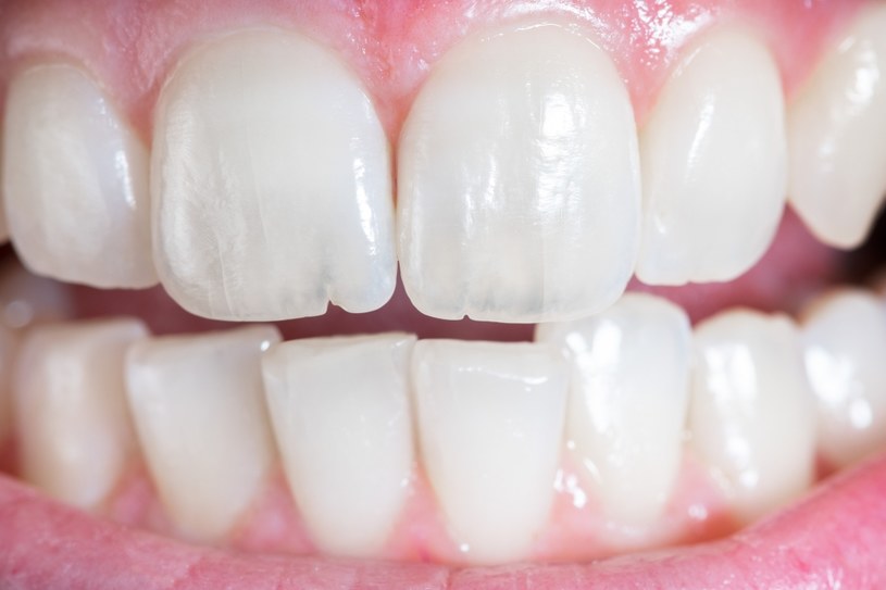 Zgrzytanie zębami to nie powód do śmiechu. Bruksizm trzeba leczyć /123RF/PICSEL