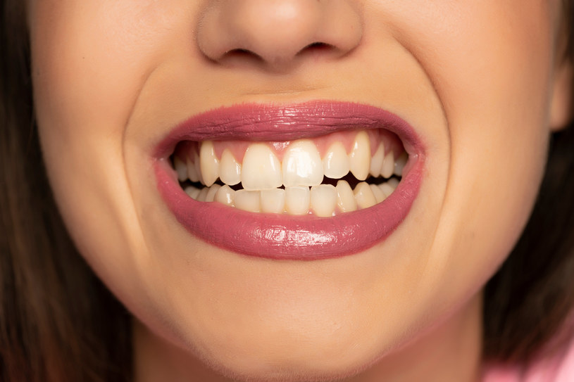 Zgrzytasz zębami? Musisz uporać się z tym problemem, jeśli chcesz cieszyć się pięknym i zdrowym uśmiechem /123RF/PICSEL