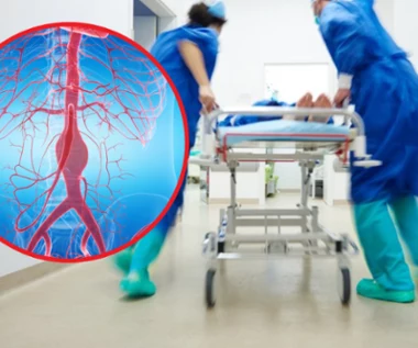 Zmarła 32-latka z Dębicy cierpiała na zespół Marfana? Choroba wywołuje m.in tętniaki 