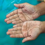 Zmarszczki na palcach po kąpieli. Co mówią o naszym zdrowiu? 