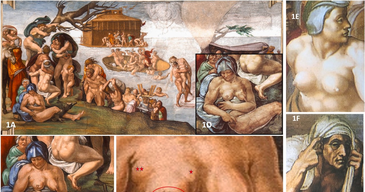 Zmiany w piersi na obrazie Mchała Anioła /Andreas G. i in., Did Michelangelo..., The Breast, 2024 r. /materiał zewnętrzny