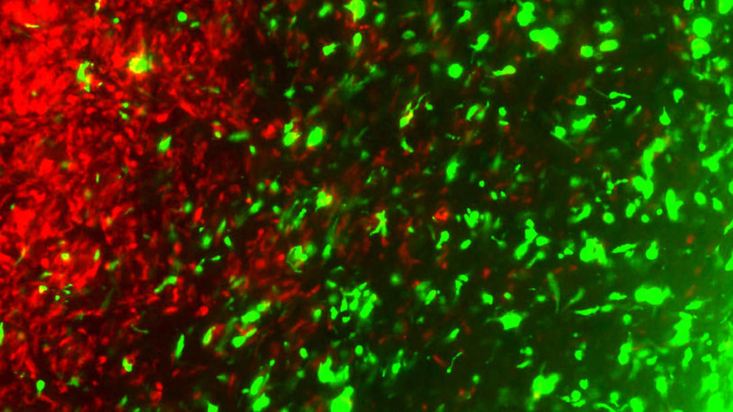 Zmienione genetycznie komórki nowotworowe (zielone) atakujące komórki guza (czerwone) /Fot. Khalid Shah Lab /materiały prasowe