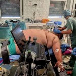 Zmniejszyli żołądek pacjentowi ważącemu prawie ćwierć tony. Rekord na stole operacyjnym w kieleckim szpitalu