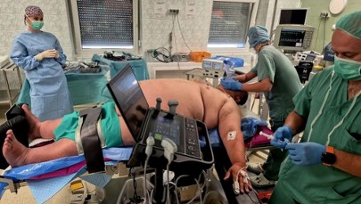 Zmniejszyli żołądek pacjentowi ważącemu prawie ćwierć tony. Rekord na stole operacyjnym w kieleckim szpitalu