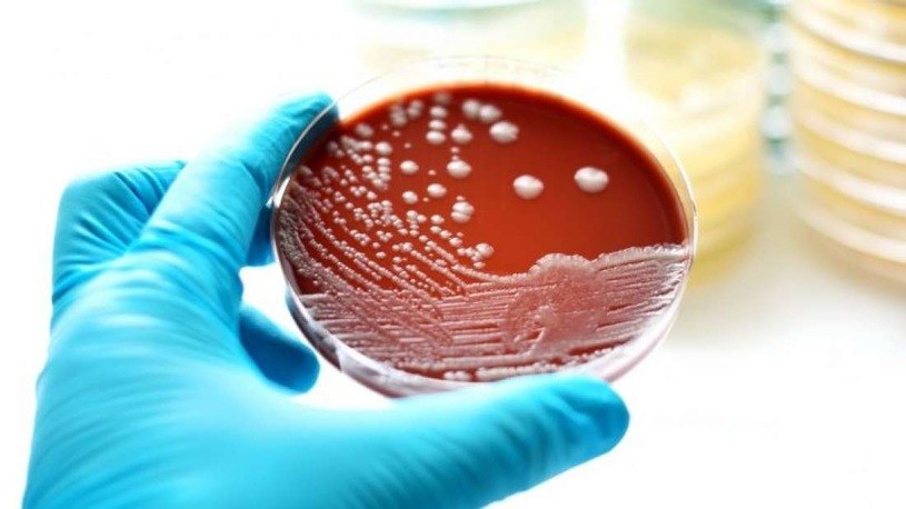 Zmutowane bakterie po powrocie na Ziemię wykazały wysoką odporność na antybiotyki /123RF/PICSEL