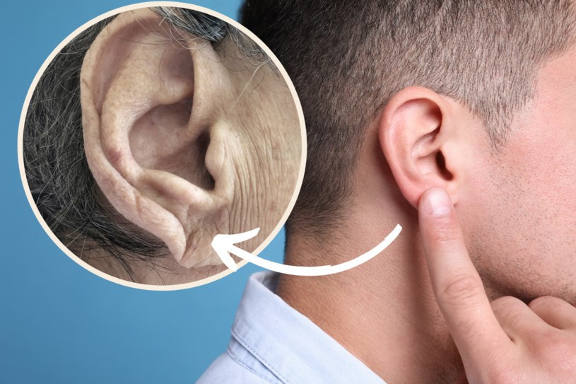 El signo de Frank es un pliegue ocasional en el lóbulo de la oreja.  Significa que algo anda mal con el corazón / 123RF / PICSEL