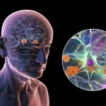 Znaleźli czynnik sprzyjający chorobie Alzheimera. Jest wokół nas