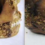 Znaleźli "prymitywną protezę" sprzed 2,5 tys. lat. Skomplikowana operacja