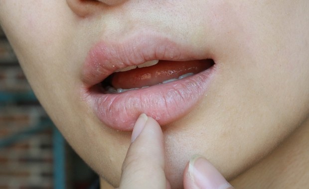 Znaleźli radę na nieprzyjemną dolegliwość