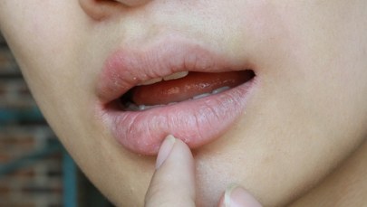 Znaleźli radę na nieprzyjemną dolegliwość