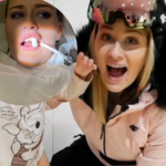 Znana Youtuberka straciła ząb. W sieci pokazała drastyczne zdjęcia
