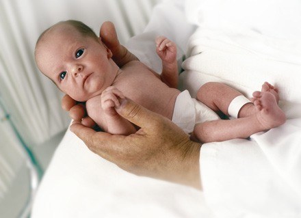 Żółtaczka rozpoczyna się zazwyczaj w 2. dobie życia dziecka i trwa 10-14 dni /ThetaXstock