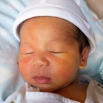 Żółtaczka u noworodków. Czy jest się czym martwić?