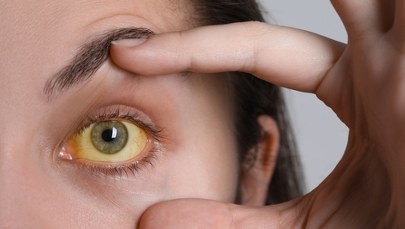 Żółtaczka w szpitalu wojewódzkim. Działania epidemiologiczne w toku