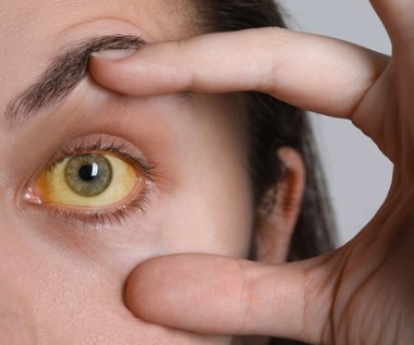 Żółtaczka w szpitalu wojewódzkim. Działania epidemiologiczne w toku