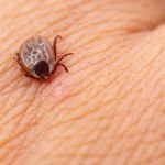 Zoolog demaskuje częsty błąd podczas usuwania kleszcza. "Traktujcie je jak tubki z boreliozą"