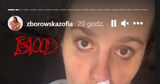 Zosia Zborowska ma krwotoki z nosa. Zdjęcie pochodzi z InstaStory z profilu https://www.instagram.com/zborowskazofia/ /Instagram/zborowskazofia  /Instagram