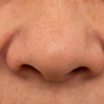 Zredukuj zaskórniki delikatnym serum z kwasem mlekowym. Jest lepsze od drogeryjnego