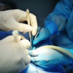 Zrób to przed operacją. Mniej powikłań i szybsza rekonwalescencja