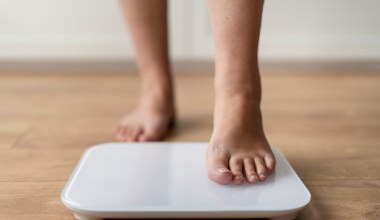 Звідси виникають набряки та важкість ногах. Найпоширеніші причини затримки води в організмі