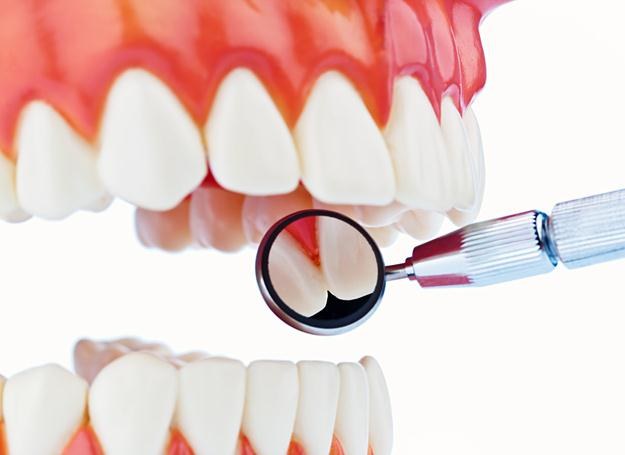 Związki z lukrecji mogłyby znaleźć zastosowanie w zapobieganiu i leczeniu schorzeń zębów /&copy; Panthermedia